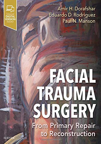 Atlas of Advanced Facial Trauma