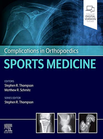 Complications in Orthopaedic Surgery: Sports Medicine