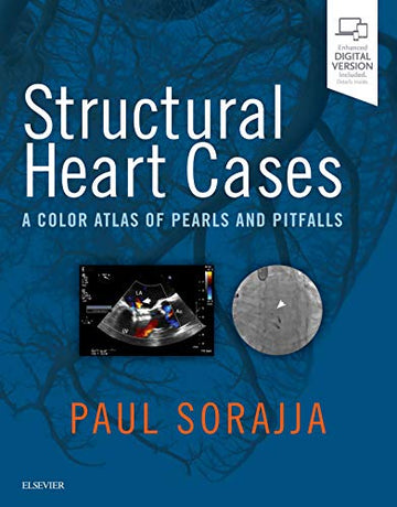 Transcatheter Therapy for Structural Heart Disease: A Color Atlas of Pearls and Pitfalls