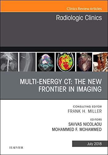 Dual Energy CT, An Issue of Radiologic Clinics of North America