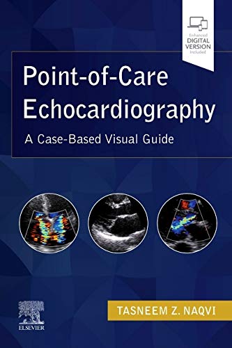 Point of Care Echocardiography