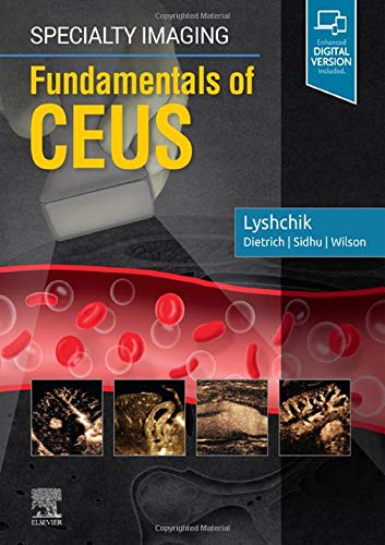Specialty Imaging: Fundamentals in Contrast-Enhanced Ultrasound