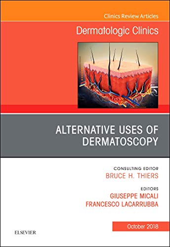 Alternative Uses of Dermatoscopy, An Issue of Dermatologic Clinics