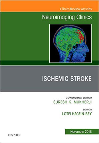 Ischemic Stroke, An Issue of Neuroimaging Clinics of North America