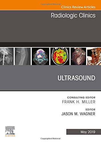 Ultrasound, An Issue of Radiologic Clinics of North America