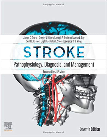 Stroke: Pathophysiology, Diagnosis, and Management