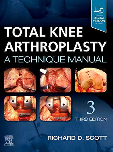 Total Knee Arthroplasty