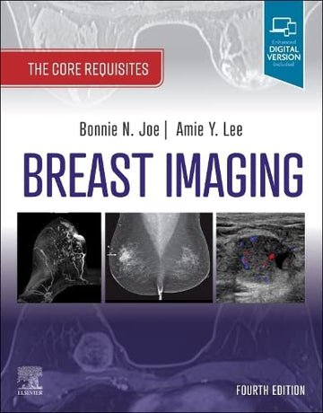 Breast Imaging: Core Requisites