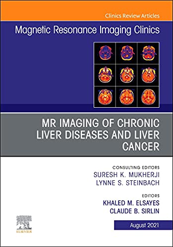 MRI of Solid Organ Transplant, An Issue of Magnetic Resonance Imaging Clinics of North America