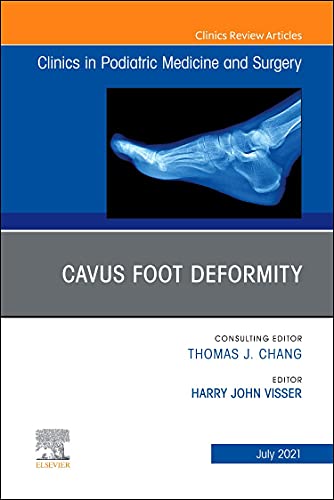 Cavus Foot Deformity, An Issue of Clinics in Podiatric Medicine and Surgery