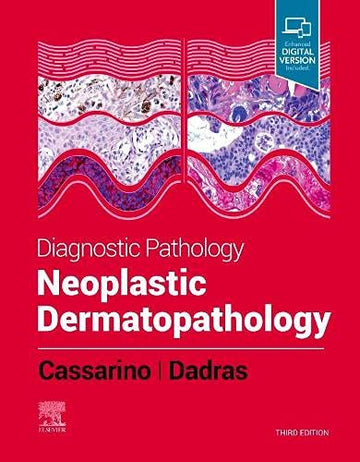 Diagnostic Pathology: Neoplastic Dermatopathology:Diagnostic Pathology