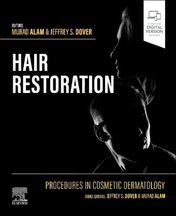 Procedures in Cosmetic Dermatology: Cosmetic Hair Restoration