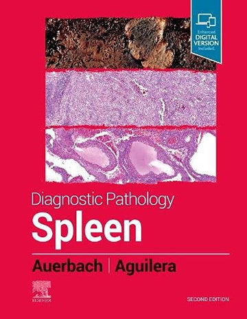 Diagnostic Pathology: Spleen:Diagnostic Pathology