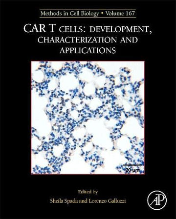 CAR T cells: development, characterization and applications