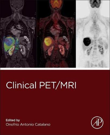 Clinical PET/MR