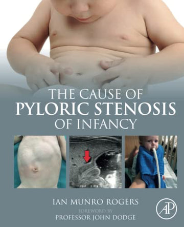 The Cause of Pyloric Stenosis of Infancy