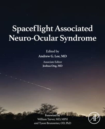 Space flight associated Neuro-ocular Syndrome