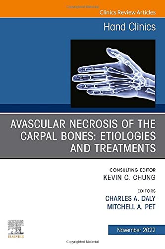 Avascular Necrosis of the Carpal Bones: Etiologies and Treatments, An Issue of Hand Clinics