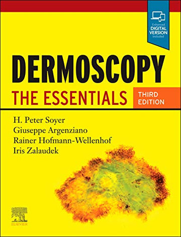 Dermoscopy:The Essentials