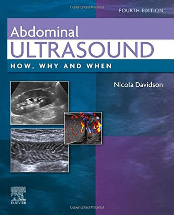 Abdominal Ultrasound 4E