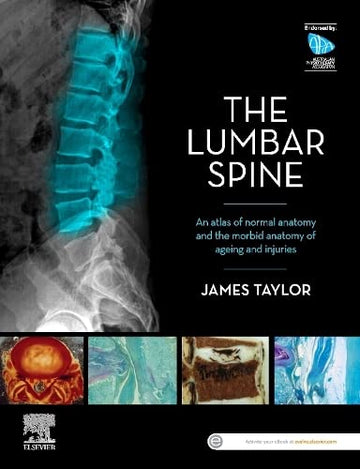 Anatomy of the Lumbar Spine: An atlas of normal anatomy and     the morbid anatomy of ageing and injury