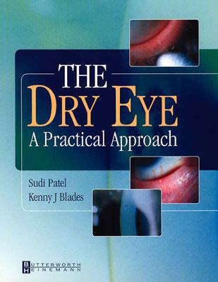 Dry Eye