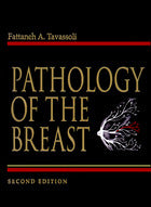 Pathology of The Breast