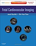 Fetal Cardiovascular Imaging: Atlas and DVD: An Atlas with DVD