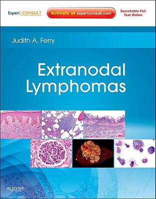 Extranodal Lymphomas: Expert Consult - Online and Print