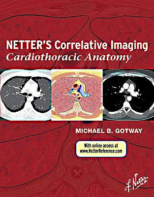 Netter's Correlative Imaging: 1e
