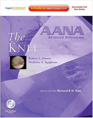 AANA Advanced Arthroscopy: The Knee: Expert Consult: Online, Print and DVD