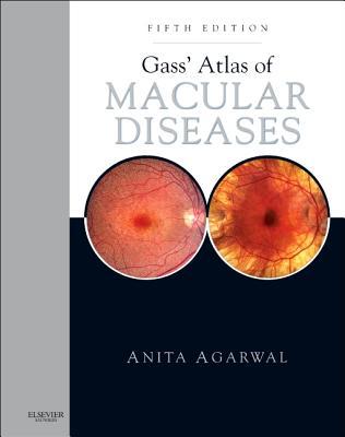 Gass' Atlas of Macular Diseases 5e