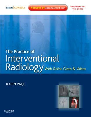 The Practice of Interventional Radiology 1e