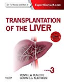 Transplantation of the Liver: 3e Expert Consult