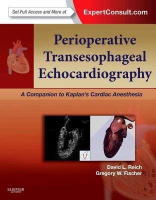Perioperative Transesophageal Echocardiography 1e