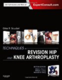 Techniques in Revision Hip and Knee Arthroplasty 1e