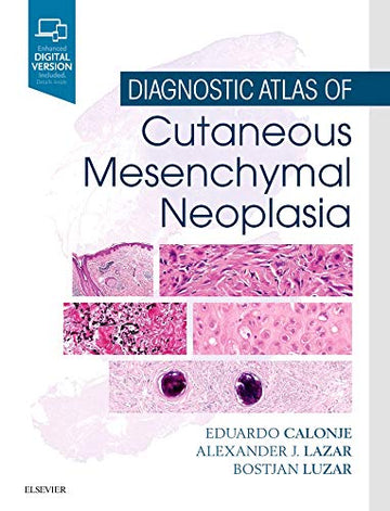 Diagnostic Atlas of Cutaneous Mesenchymal Neoplasia: Expert Consult - Online and Print