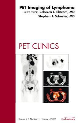 Lymphoma, Vol 7-1 An Issue of PET Clinics