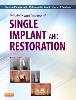 Principles and Practice Single Implant and Restorations 1e