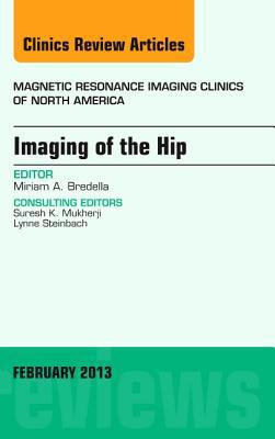 Imaging of the Hip