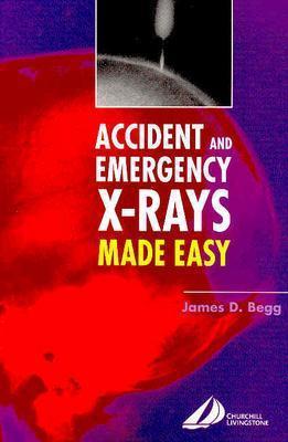 Accident and Emergency X-Rays Made Easy:Made Easy Book Land AU