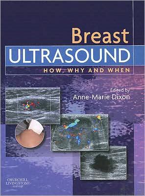 Breast Ultrasound:How, Why and When:How, Why and When Book Land AU