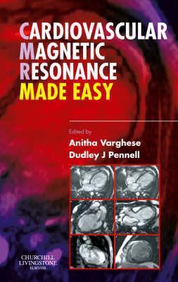 Cardiovascular Magnetic Resonance Made Easy:Made Easy Book Land AU