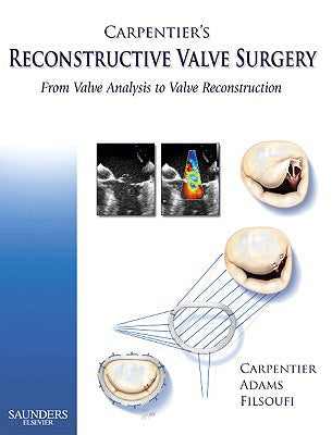 Carpentier's Reconstructive Valve Surgery Book Land AU