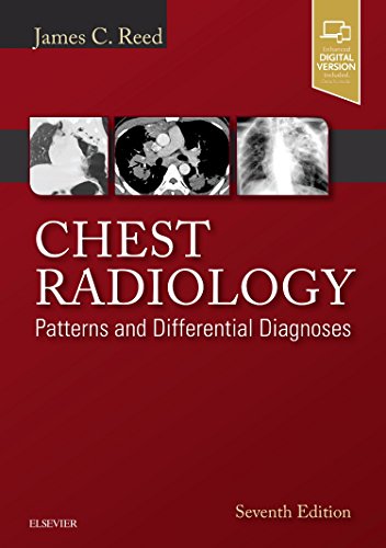 Chest Radiology:Patterns and Differential Diagnoses Book Land AU