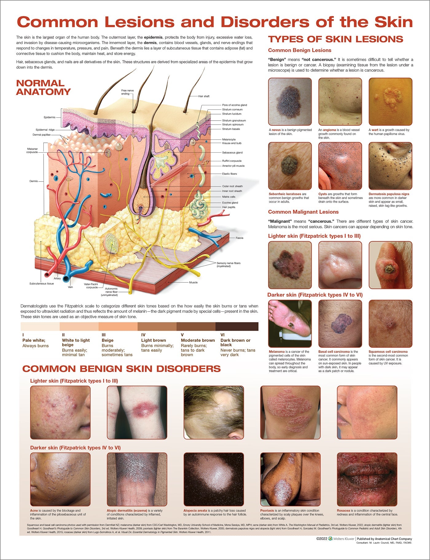 Common Lesions and Disorders of the Skin Anatomical Chart       Laminated Book Land AU